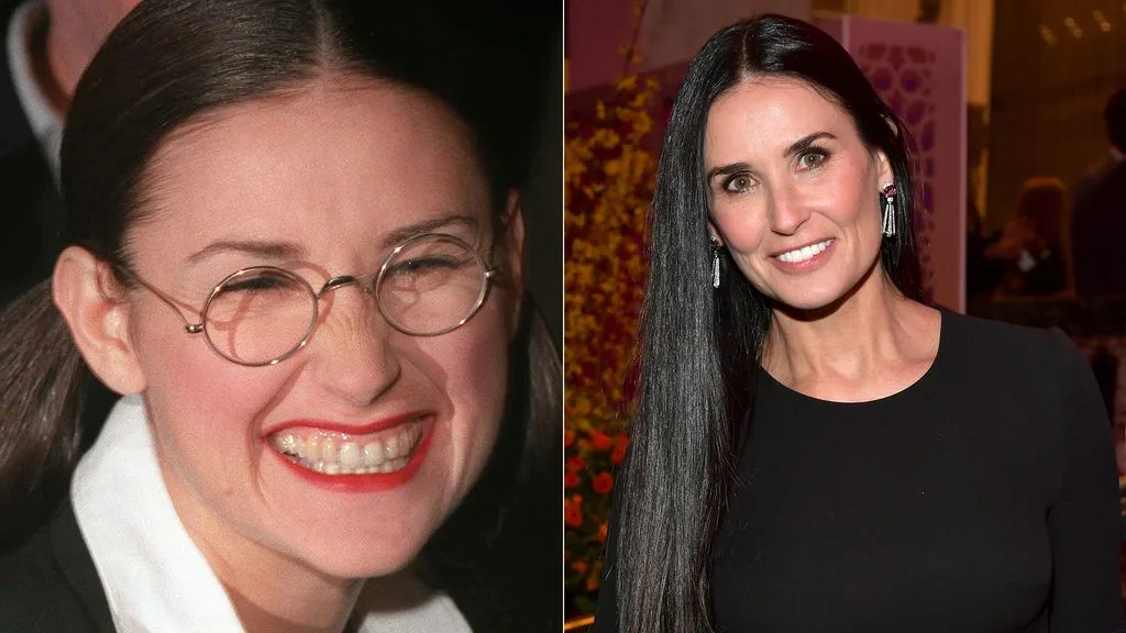 demi-moore-s-smile-and-teeth